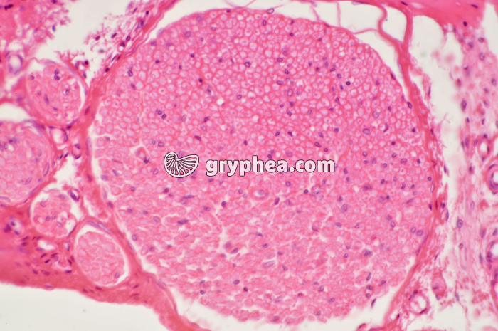 Nerf CT x25 - gryphea.com